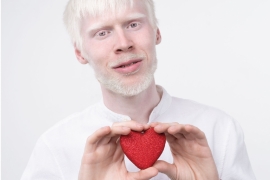 Imágen de Da Internacional de Sensibilizacin sobre el Albinismo